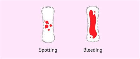 What Does Spotting Look Like In Early Pregnancy