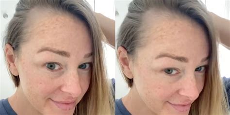 jamie otis shows “bald spots” from postpartum hair loss on instagram