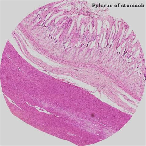Histology Of Stomach Pylorus Of Stomach Depth Of Gastric Pit More