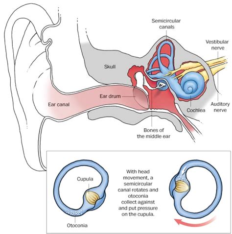 What are ear crystals, anyway? Vertigo: Source of the spinning - The Washington Post