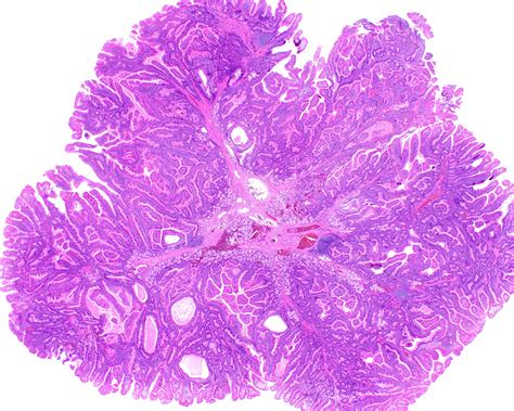 UMiami Pathology (@UMiamiPathology) / Twitter