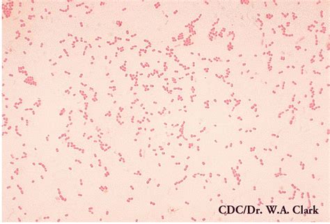 Gram Negative Bacilli Rods Microbiology Learning The Whyology Of