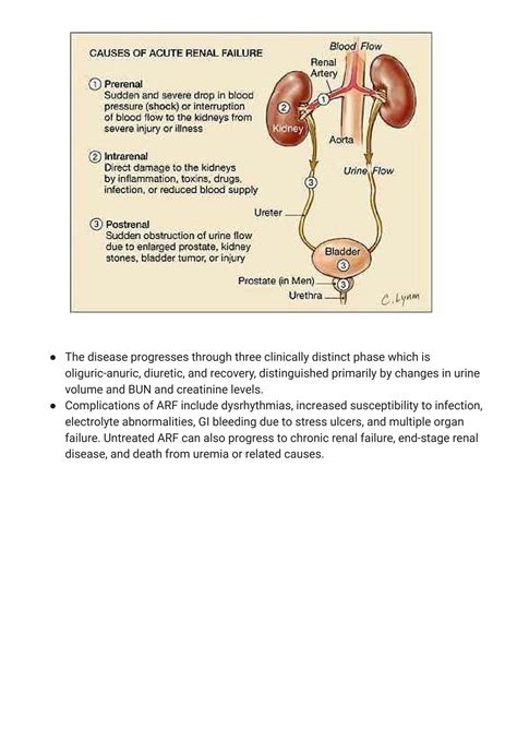 Solution Acute Renal Failure Nursing Care Plan And Management Studypool