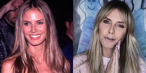 Has Heidi Klum Had Plastic Surgery Nose And Face Before And After