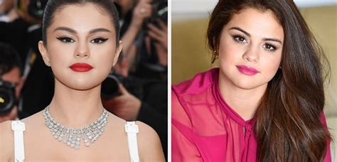Selena Gomez Usou Um Maiô Que Mostra A Cicatriz De Seu Transplante De Rim E Ela Está Incrível