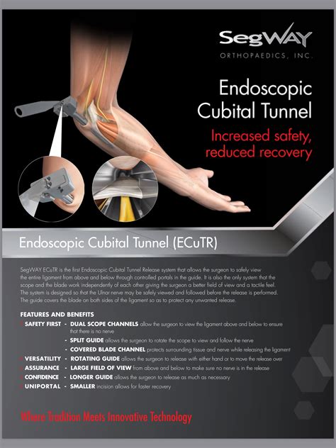 Seg Way Endoscopic Cubital Tunnel Release Pacific Medical Inc