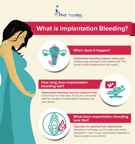 Early Pregnancy Implantation Bleeding Look Like Diy Craft