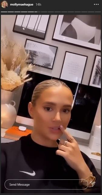 Molly Mae Hague Reveals Her Natural Lips Are ‘stretched’ By Fillers After They Were Dissolved
