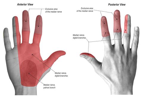 Pronator Syndrome Hand Orthobullets