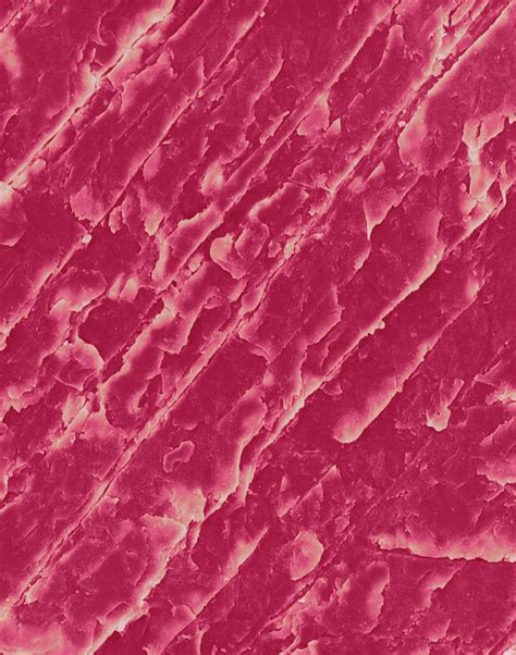 Human Fingernail Surface Photograph By Dennis Kunkel Microscopyscience