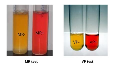 Methyl Red And Voges Proskauer Test Principle Result