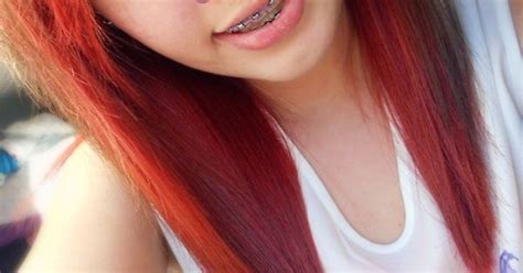 Sweet Blue Eys Tooth Braces Girl With Freckles And Nose Piercing