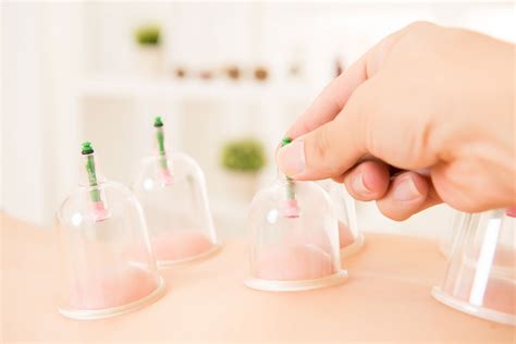 Cupping Hlc Wellness And Aesthetic