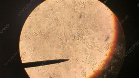 Trichomonas Vaginalis Parasite Light Microscopy Stock Video Clip