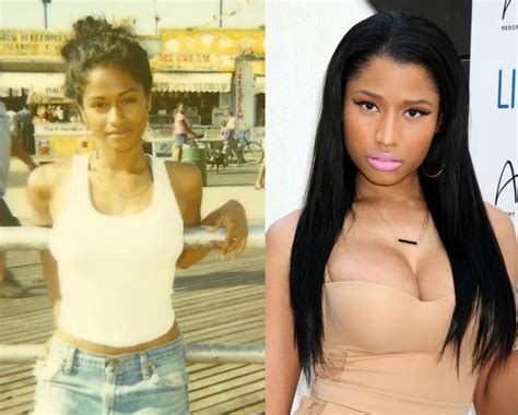 Nicki Minaj Before An After Plastic Surgery Celebrity Plastic Surgery