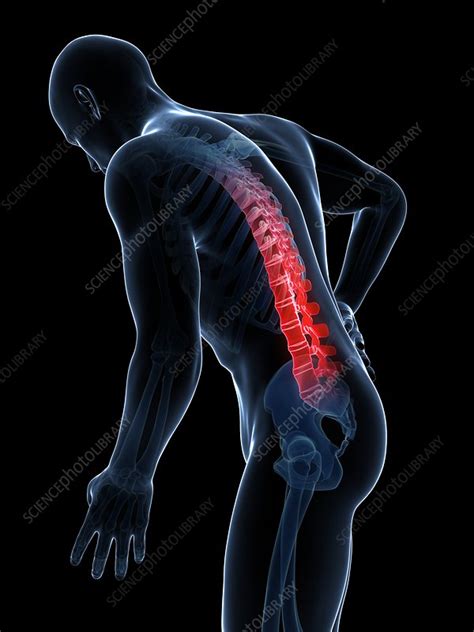 Human Back Pain Artwork Stock Image F0105746 Science Photo Library