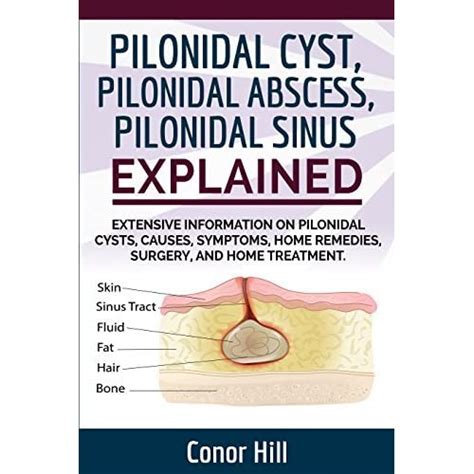 Pilonidal Sinus Why Do Pilonidal Cysts Smell So Bad Are Pilonidal