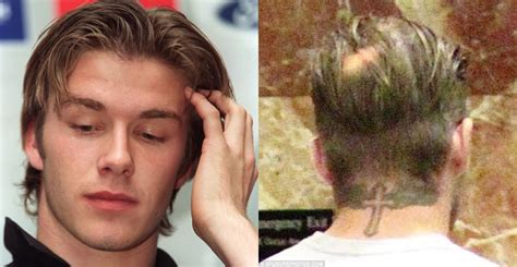 The Truth Behind The David Beckham Hair Transplant Rumours His Hair