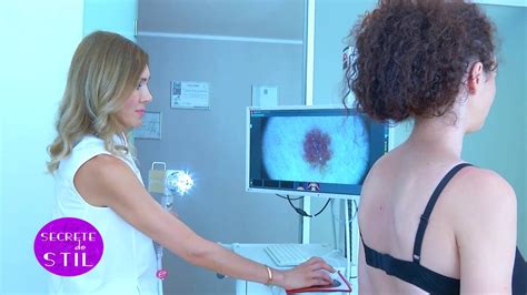 dr oana spanu dermatoscopie alunite fotofinder diagnostic cancer piele youtube