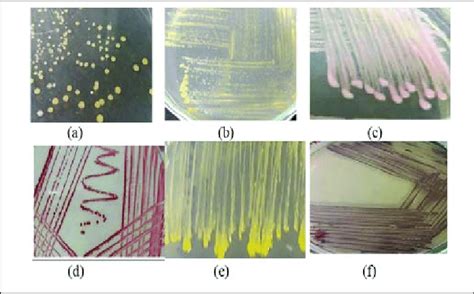 Characteristics And Growth Of Bacteria Morphotypes On Media Zobell Download Scientific Diagram