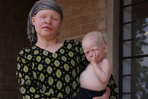 Tanzania Albinism Collective — Six Degrees Records