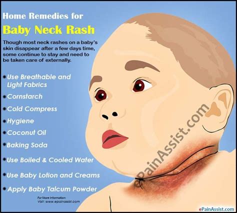 Baby Neck Rash Rash On Neck Remedies