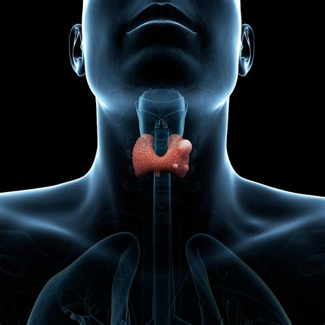 Thyroid Gland Cancer Photograph By Scieproscience Photo Library Pixels
