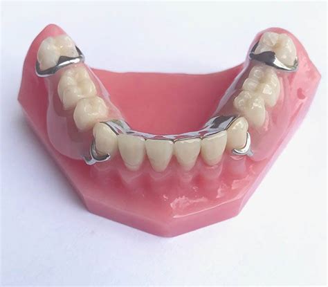 Best Partial Dentures To Restore Your Smile Shelby Dental Center