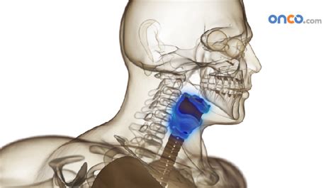 Check spelling or type a new query. Stage 3 Throat Cancer | Locally advanced throat cancer ...