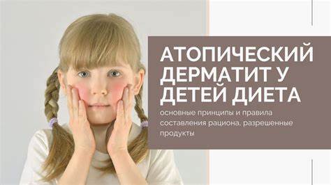 Диета 1 разрешенные продукты Атопический дерматит у детей диета: основные принципы и правила Атопический дерматит у детей диета: основные принципы и правила Диета 1 разрешенные продукты