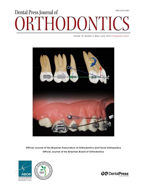 Dental Press Journal Of Orthodontics V19 N3 Mayjun By Dental Press