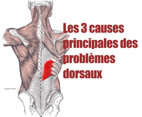 Pour bien comprendre d'où peuvent provenir certains maux de dos, une petite révision d'anatomie s'impose. Tout savoir sur la hernie discale