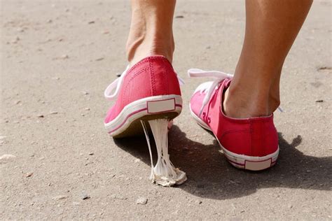 Easy Steps To Remove Chewing Gum Off Your Shoes