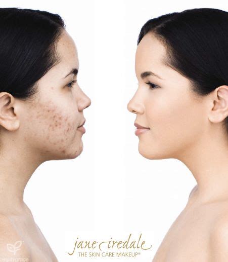 Jane Iredale Before And After Photos Beauty Grace Jane Iredale