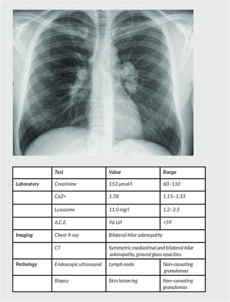 Lung Parenchyma Meaning Lung Sampling For Stereology A Lung Fixation