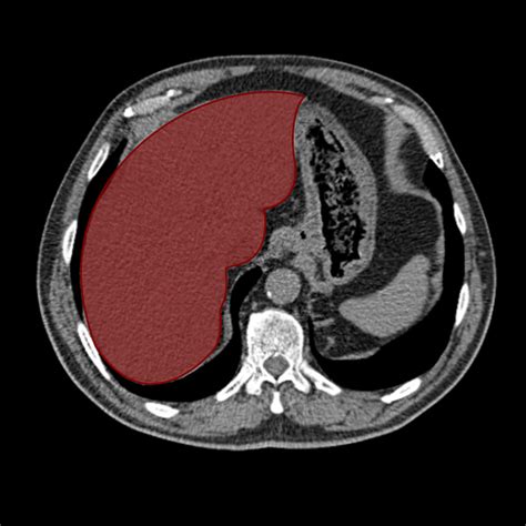 What Is A Liver Ct Scan Two Views