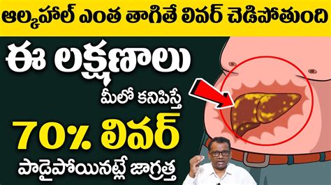 Dr Kiran Peddi About Fatty Liver Symptoms Telugu Early Signs Of