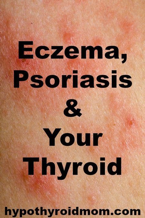 Eczema Psoriasis And Your Thyroid Is There A Connection Psoriasis