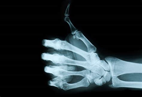 550 Funny Xray Stock Photos Pictures And Royalty Free Images Istock