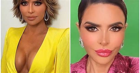 Lisa Rinna Before And After The Criticism She Got On Social Media Imgur
