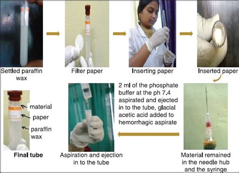 The Steps Involved In The Manual Liquid Based Cytology Technique