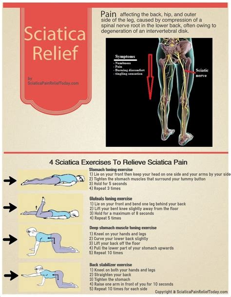 Sciatic Nerve Pain Symptoms