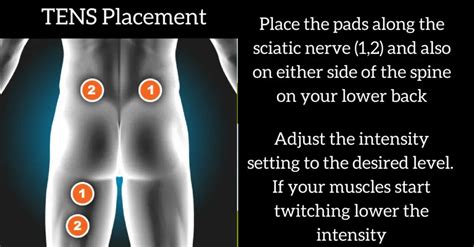 TENS Unit Placement For Sciatica Nerve Pain Optimize Health