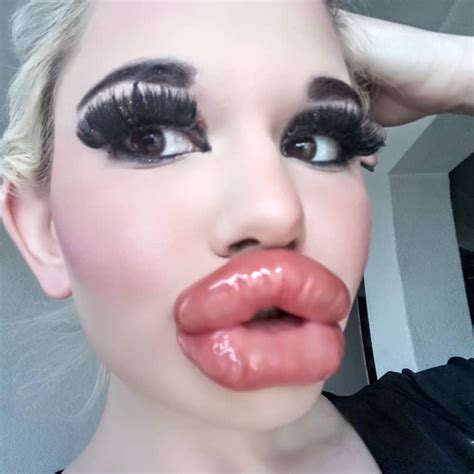 Biggest Lips In D World