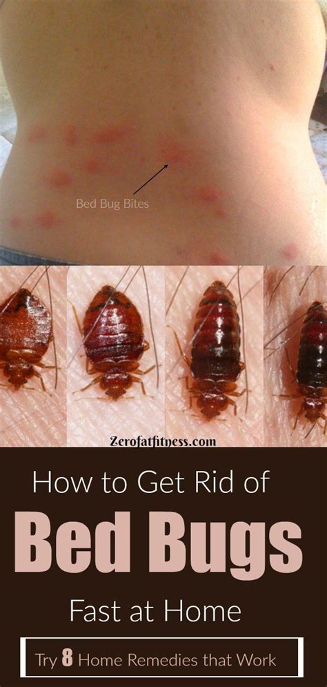 7 Essential Oils To Get Rid Of Bugs At Home Rid Of Bed Bugs Bed Bugs
