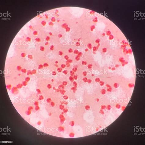 White Blood Cells Stock Photo Download Image Now Microscope Cancer