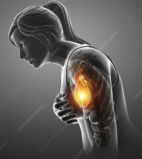 Woman With Chest Pain Illustration Stock Image F022