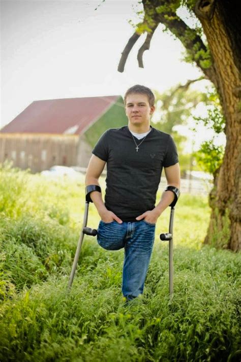 Amputee Legs Stumps And Prostheses — Theivorlegov1 Looking Handsome