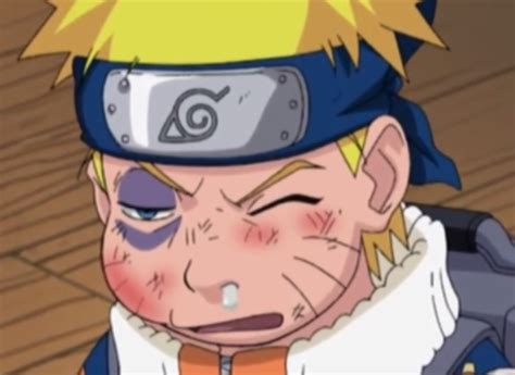 Beaten Up Anime Naruto Naruto Uzumaki