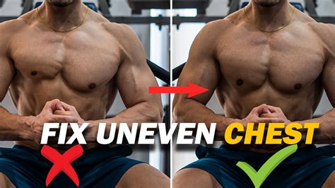 Do This To Fix Uneven Chest Muscle Imbalance छोटी बड़ी चेस्ट का इलाज